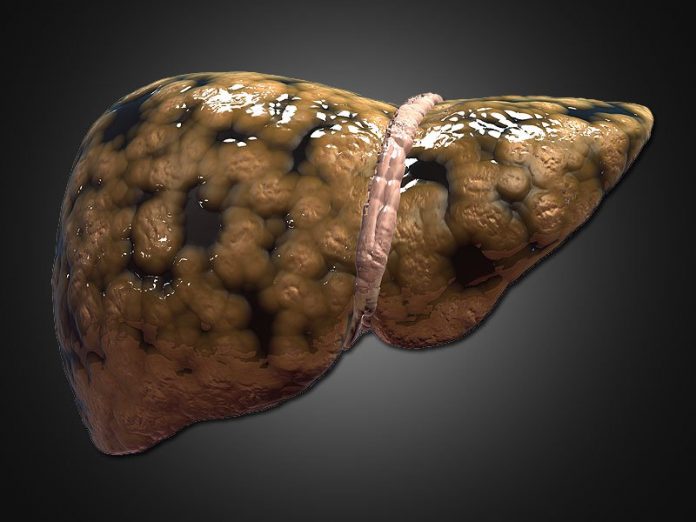 fatty_liver fatty_liver