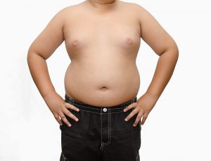 چاقی در دوران کودکی